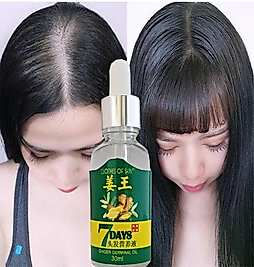 7DAYS 30ML GİNGERGERMİNALESSENTİALOİL HAİR GROWTH LOSS TREATMENT SERUM UNİSEX 3 ADET SAÇ BAKIM YAĞI