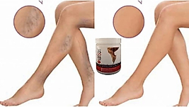 VARİSON VÜCUTKREMİ 200ML+50ML AYAKKREMİ