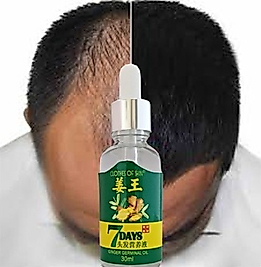 7DAYS 30ML GİNGERGERMİNALESSENTİALOİL HAİR GROWTH LOSS TREATMENT SERUM UNİSEX SAÇ BAKIM YAĞI